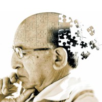 Alzheimer