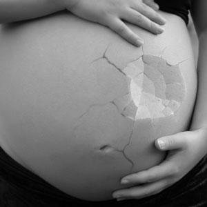 Dol perinatal Dol perinatal